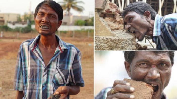 คนติดดินของจริง!! พบกับหนุ่มอินเดียผู้เสพติดการกิน “หิน ดิน โคลน” เป็นชีวิตจิตใจ