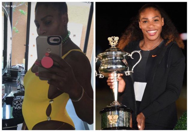 Serena Williams ชนะการแข่งทั้งๆ ที่ตั้งท้อง 20 สัปดาห์ กับคู่หมั้นผู้ก่อตั้งเว็บ Reddit!!