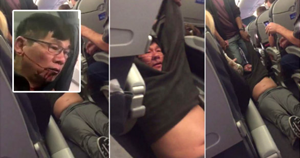 United Airlines ใช้กำลังลากผู้โดยสารลงจากเครื่อง จนบาดเจ็บ-มีดราม่า หลังขายตั๋วเกิน??