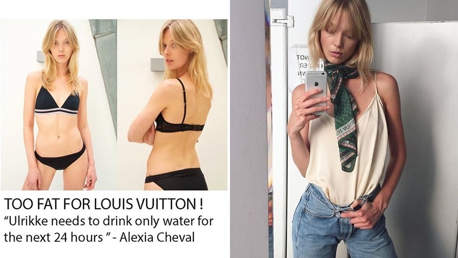 นางแบบสาวโพสต์ Louis Vuitton ตัดเธอจากแฟชั่นโชว์ ด้วยเหตุผลที่ว่า “เธออวบเกินไป”!!
