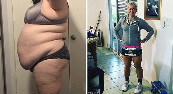 หมอบอกหญิงสาวอาจอยู่ไม่ถึงอายุ 40 ปี เธอเลยฟิตจนลดน้ำหนักได้ถึง 100 กก.