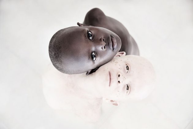 ช่างภาพเผยภาพถ่ายของ “เด็กผิวเผือก” ในแทนซาเนีย ที่แสดงให้เห็นถึงความงามของพวกเขา