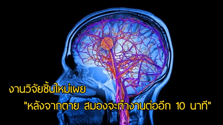 การวิจัยใหม่พบว่า “สมองยังคงทำงานต่อ หลังจากที่ตายไปแล้ว ประมาณ 10 นาที”