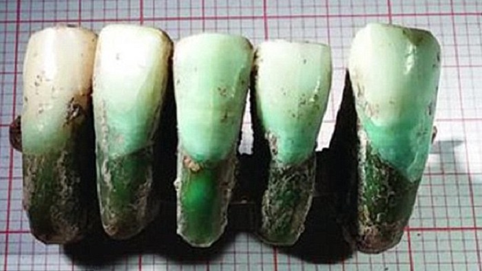 ทีมสำรวจค้นพบฟันปลอมสีเขียวที่เก่าแก่ที่สุดในยุโรป คาดว่ามีมาตั้งแต่ศตวรรษที่ 14