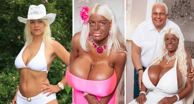 ‘Martina Big’ แอร์โฮสเตสผิวขาว ผู้ผันตัวเป็นนางแบบผิวสี ด้วยหน้าอกไซส์ 32S ใหญ่สุดในยุโรป..!!