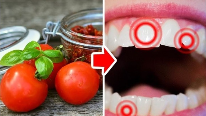 10 อาหารที่เป็นภัยร้ายต่อฟันสุดสวยของคุณ ถ้ายังอยากฟันงามอยู่ ก็เลี่ยงซะเถอะนะ!!