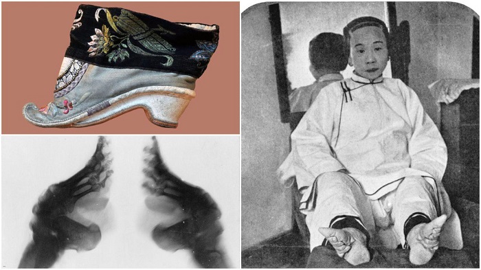 พิธีการรัดเท้า หรือที่เรียกว่า ‘เท้าดอกบัว’ ความงดงามสุดแปลกตาตามแบบฉบับจีนโบราณ…