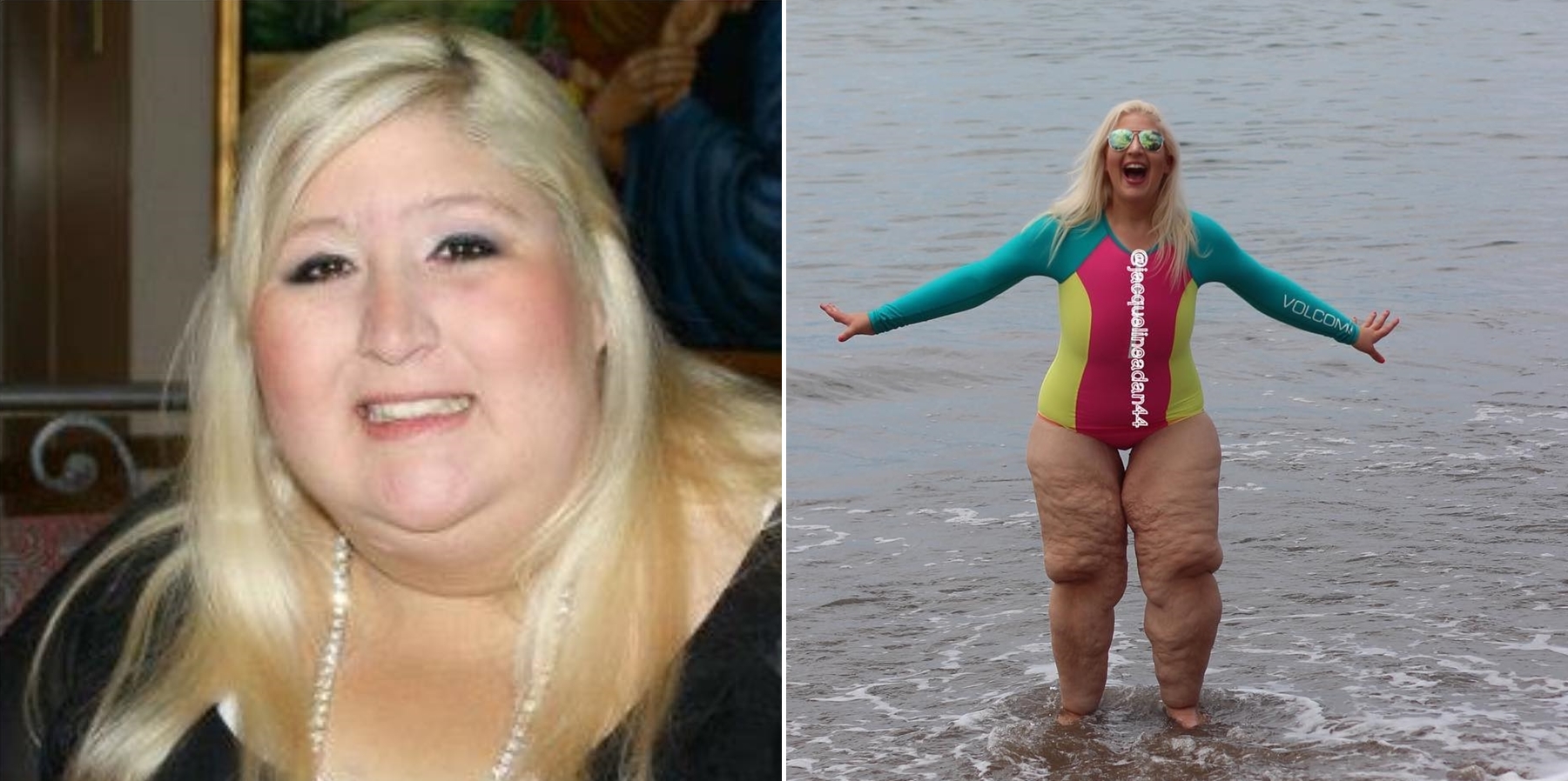 สาวลดน้ำหนักลงได้ 158 กิโลแต่ยังมี ‘ขาย้วย’ โดนคนหัวเราะเยาะ เธอเลยตอบกลับซะหน้าหงาย!!