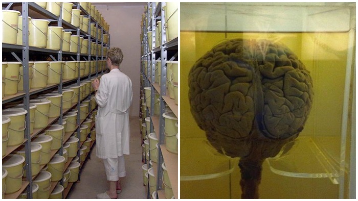 8 พิพิธภัณฑ์เกี่ยวกับ ‘สมอง’ ที่ทำให้เราได้เห็นสมองของผู้ที่ป่วยโรคทางประสาทนานาชนิด