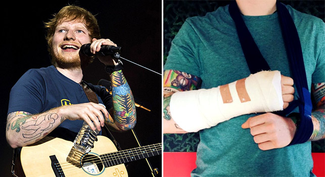 Ed Sheeran ประสบอุบัติเหตุแขนหัก แฟนๆ ลุ้น อาจหมดสิทธิ์มาทัวร์คอนเสิร์ตในไทย!?