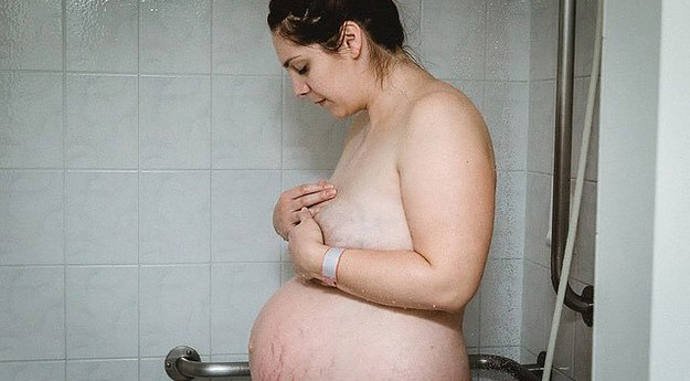 ภาพไวรัลทั่วโลกออนไลน์ แสดงให้เห็นว่า “พุง” ของคุณแม่จะเป็นยังไง เมื่อเธอคลอดลูก..