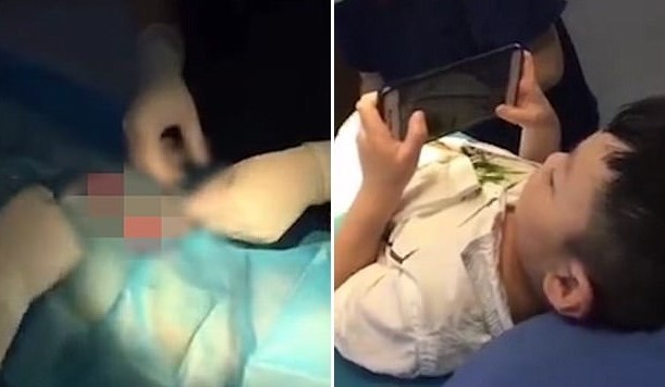 โรงพยาบาลในจีนให้เด็กเล่น ROV ขณะ “ขลิบกระปู๋” ได้ แถมมอบส่วนลดสุดพิเศษหากได้คะแนนสูง