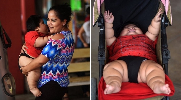 ชีวิตอันยากลำบากของ ‘เด็กอ้วนที่สุดในโลก’ อายุเพียง 10 เดือนแต่หนักเท่าเด็ก 9 ขวบ!!
