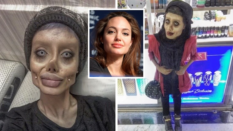 หญิงสาวผู้ผ่านการทำศัลยกรรมมาแล้วกว่า 50 ครั้ง เพื่อให้มีใบหน้าเหมือน Agelina Jolie