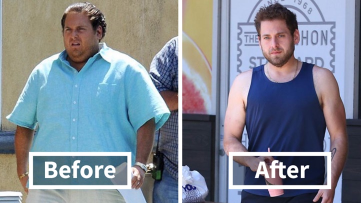 25 ภาพก่อน-หลังการลดน้ำหนัก ที่เปลี่ยนไป จนไม่น่าเชื่อว่านี่คือคนเดียวกัน…