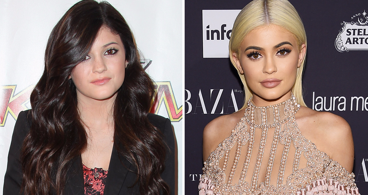 19 ภาพพัฒนาการความสวยของ Kylie Jenner จากวัย 12 มาจนถึงตอนนี้ เปลี่ยนไปขนาดไหน…