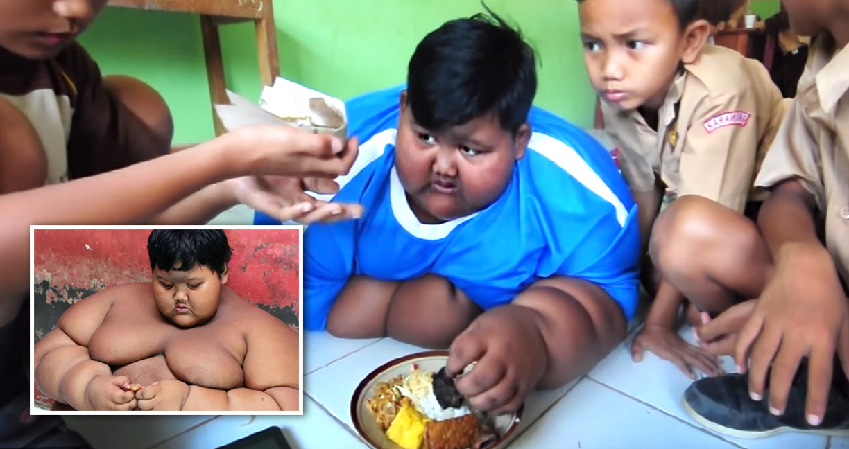 เด็กชายที่อ้วนที่สุดในโลก ตอนนี้ลดน้ำหนักสำเร็จแล้ว ออกไปเล่นกับเพื่อนๆ ได้สมใจอยาก
