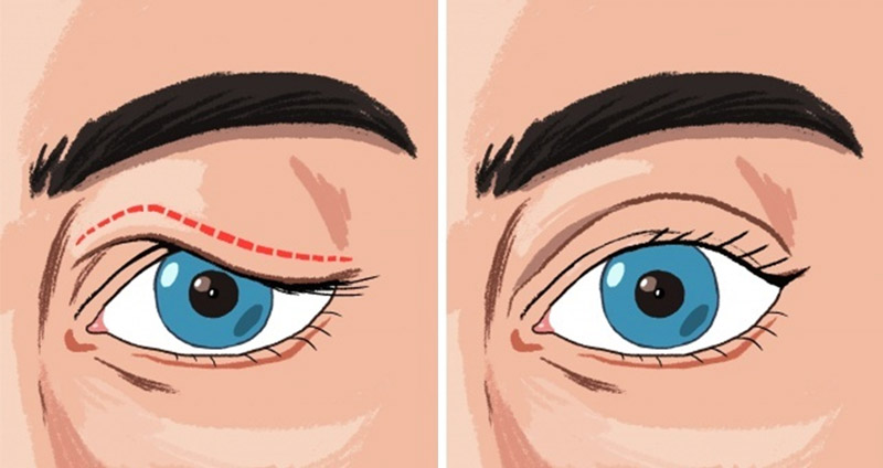 7 เคล็ดลับแสนง่าย ที่ช่วยให้ดวงตาหย่อนคล้อยของคุณ กลับมาเด้งกระชับสวยงาม