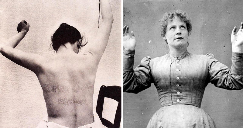 เผยภาพหลอนจากโรงพยาบาลบ้าในอดีต ของผู้ป่วยโรค ‘ฮิสทีเรียหญิง’ จากศตวรรษที่ 19