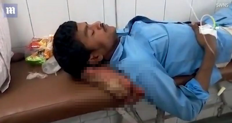 หนุ่มอินเดียประสบอุบัติเหตุขาขาด แต่หมอไม่มาสักที นานจนเขาต้องเอาขาที่ขาดมาเป็นหมอน
