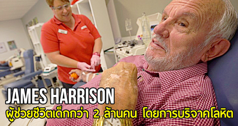James Harrison “วีรบุรุษแขนทองคำ” ผู้ช่วยชีวิตเด็กกว่า 2 ล้านคนโดยการบริจาคโลหิต