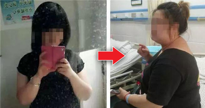 สาวจีนซื้อยาลดน้ำหนักมากินติดต่อกัน 7 ปี แต่น้ำหนักพุ่งมากกว่าเดิม 2 เท่า!?