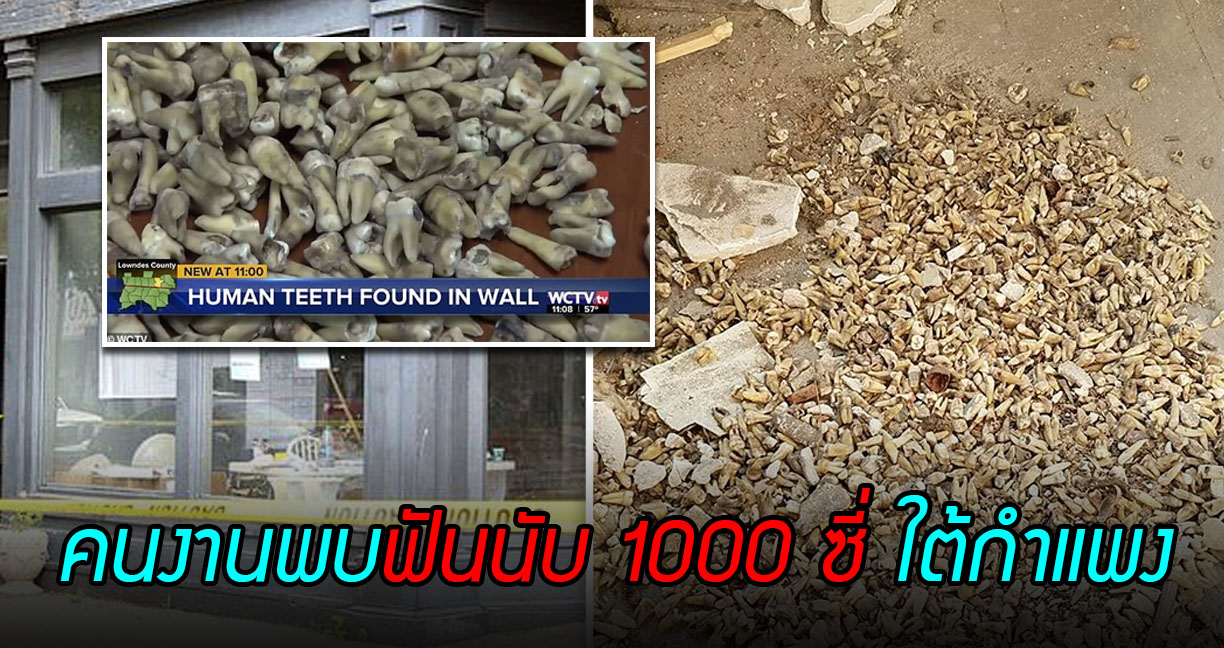 คนงานผงะทุบตึกพบ ‘ฟันมนุษย์’ นับ 1,000 ซี่ซ่อนอยู่ในกำแพง พบเคยเป็นตึกของหมอฟันมาก่อน!!