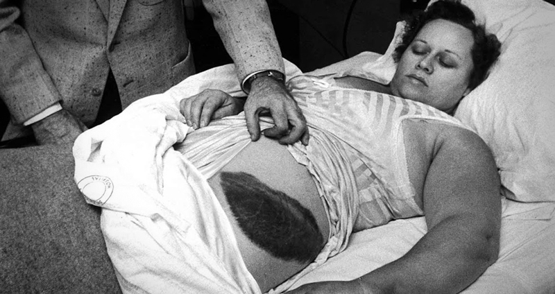 ชมเรื่องราวของ “แอนน์ ฮอดเจส” หญิงคนเดียวในโลก ที่นอนอยู่เฉยๆ ก็ถูกอุกกาบาตตกใส่