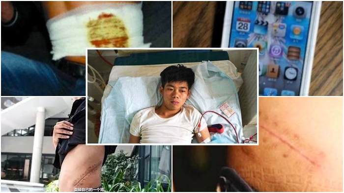 หนุ่มจีนยอมขายไตเพื่อนำไปซื้อ iPhone 4 เมื่อ 7 ปีก่อน ต้องนอนเป็นผัก จากแผลติดเชื้อ