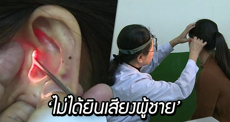 หญิงชาวจีนพบแพทย์หลังไม่สามารถได้ยินเสียง “ผู้ชาย” เชื่อเกี่ยวข้องกับหูชั้นในรูปหอยโข่ง