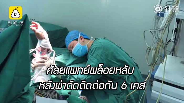 ชาวเน็ตชื่นชม ศัลยแพทย์จีนยอมทำงานหนัก ผ่าตัดติดกัน 6 เคส จนผล็อยหลับกลางห้องผ่าตัด