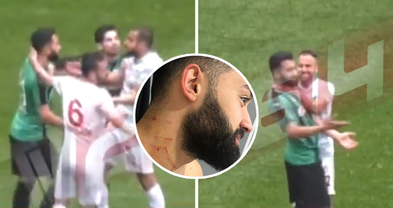 นักฟุตบอลลีคตุรกีแอบพก “มีดโกน” ลงสนาม ก่อนใช้มันเฉือนคอ+แขนผู้เล่นฝั่งตรงข้าม