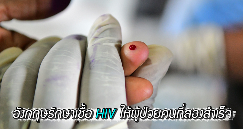 อังกฤษประสบความสำเร็จ ในการรักษาเชื้อ HIV ให้กับผู้ป่วยคนที่สองในประวัติศาสตร์โลก