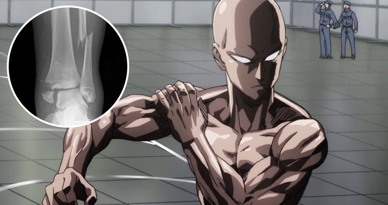 หนุ่มมาเลฯ ทำ “One Punch Man Workout Challenge” ได้ 2 เดือน กระดูกข้อเท้าหัก!!