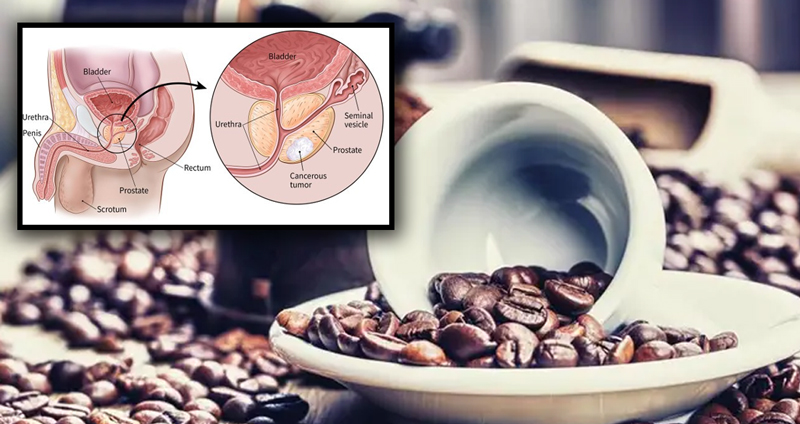 นักวิจัยค้นพบความเป็นไปได้ว่า สารใน ‘เมล็ดกาแฟ’ ช่วยยับยั้งเซลล์มะเร็งต่อมลูกหมาก