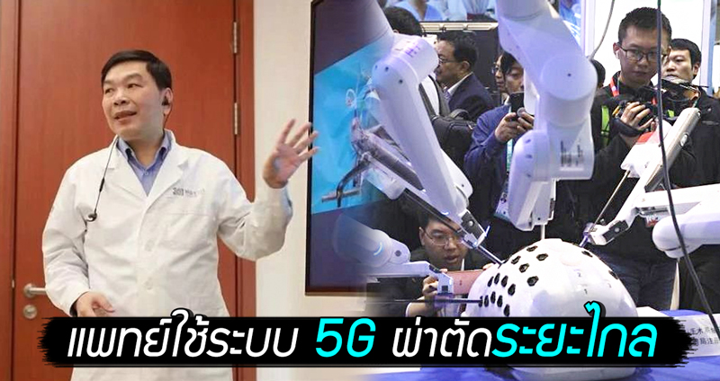 อีกระดับของการแพทย์!! หมอจีนใช้สัญญาณ 5G ผ่าตัดสมองคนไข้ที่อยู่ไกลกว่า 3,000 กม. สำเร็จ