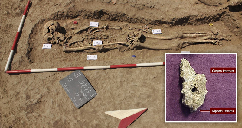 นักวิทย์ไขปริศนา 2,000 ปี หลังมีการพบรูกลมๆ กลางอกโครงกระดูกโบราณที่ประเทศกรีซ