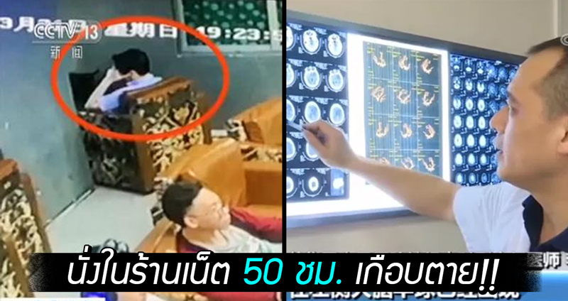 ชายนั่งในร้านเน็ตนานกว่า 50 ชม. เกือบตายด้วยอาการอัมพาต & โรคหลอดเลือดสมอง