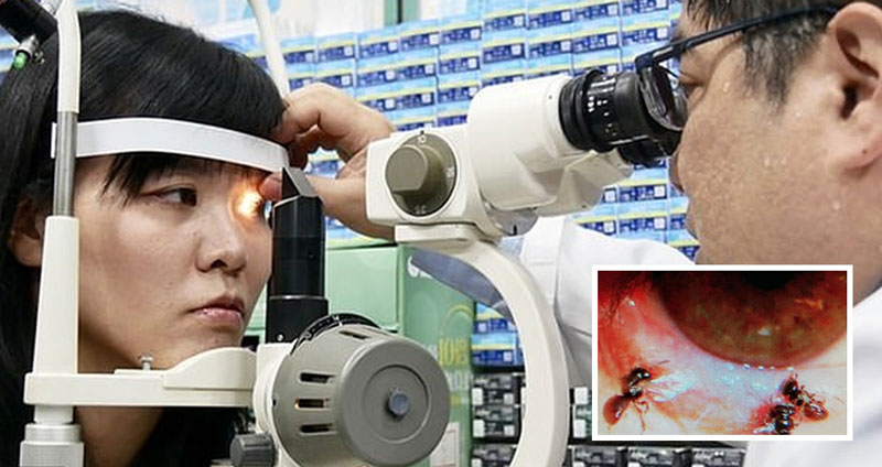 แพทย์จีนตรวจพบ ‘ผึ้งในตา’ ของหญิงสาว เผยสาเหตุแค่เข้ามาดื่มน้ำตาของเธอ