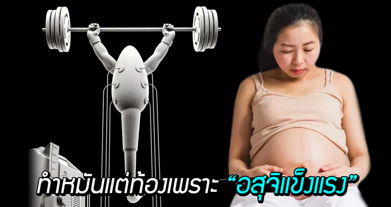 ภรรยาสุดตกใจ ทำหมันแล้ว ยังตั้งครรภ์โดยไม่ตั้งใจ หมอแซว “อสุจิแข็งแกร่งเกินไป!!”