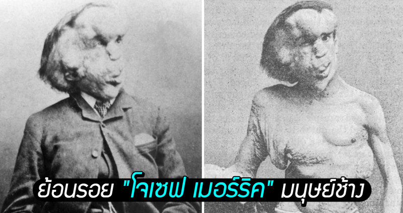 ย้อนรอย “โจเซฟ เมอร์ริค” มนุษย์ช้างแห่งศตวรรษที่ 19 ผู้มีชีวิตรันทดยิ่งกว่าละคร