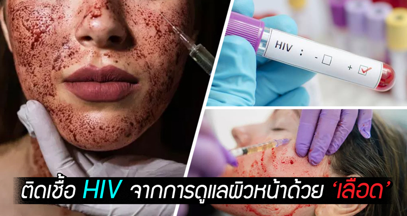 นิวเม็กซิโกพบผู้ติดเชื้อ HIV 2 ราย คาดอาจติดจากคลินิก ที่ทรีทเมนต์ผิวหน้าด้วยเลือด