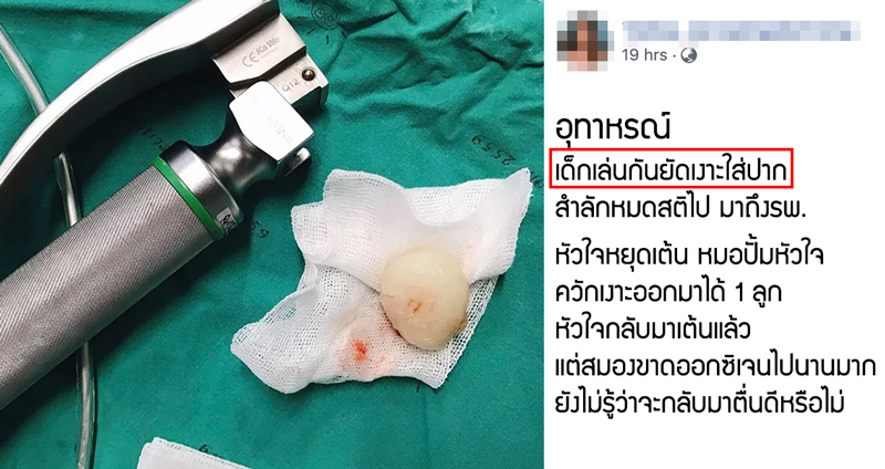 อุทาหรณ์!! สาวเจอกับตัว “เงาะติดคอเด็ก” จนเกือบไม่รอด พร้อมแนะวิธีช่วยเหลือเบื้องต้น