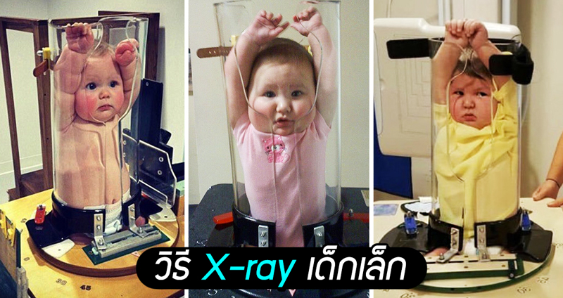 เคยสงสัยไหมว่า คุณหมอจับเหล่า “เด็กน้อย” ให้อยู่นิ่งๆ เพื่อ X-ray ได้อย่างไร?